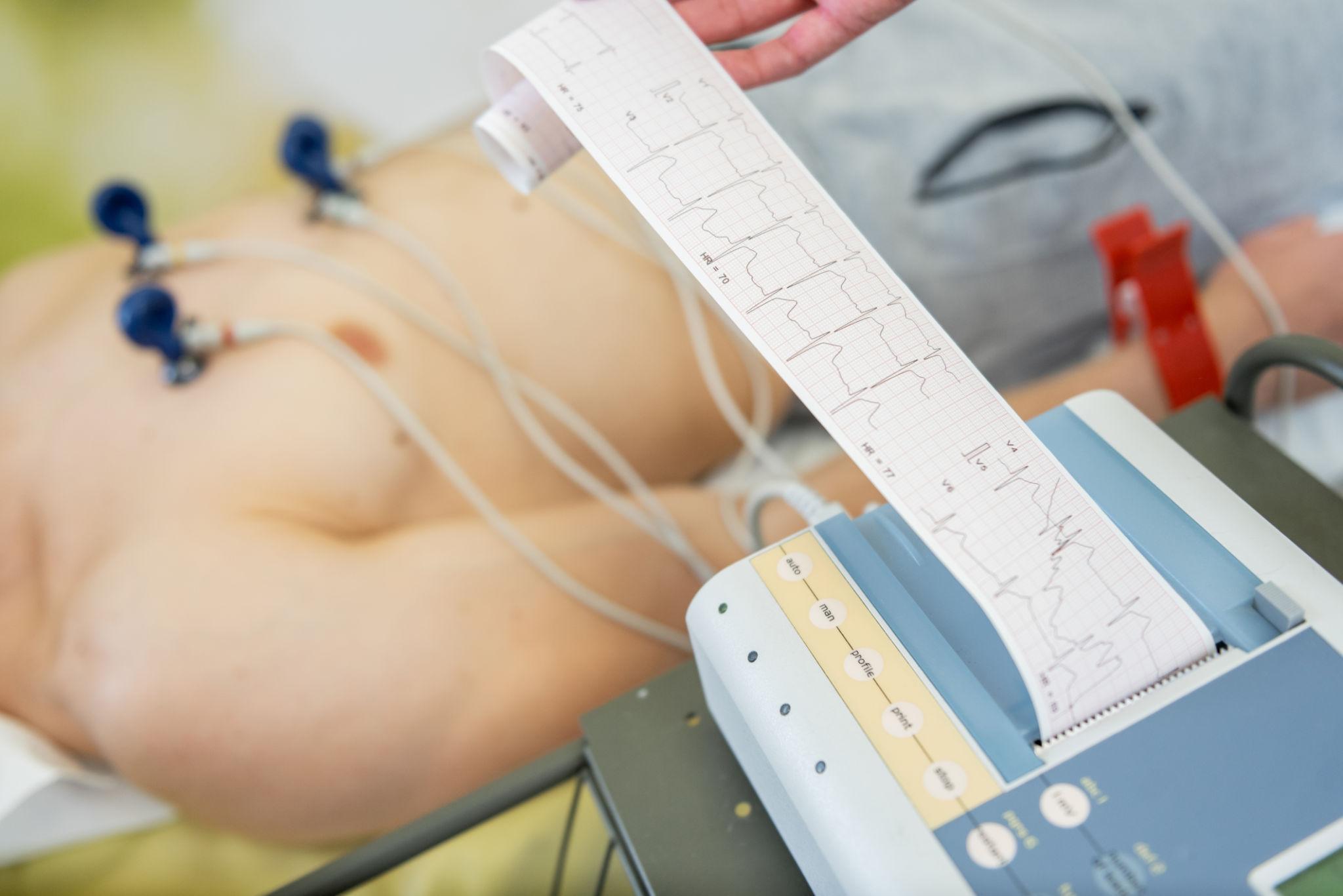 Holter and ABPM Testing
